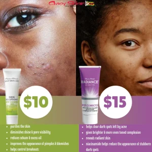 Radiance 🟣 And Skin Solutions 🟢  Spot Corrector